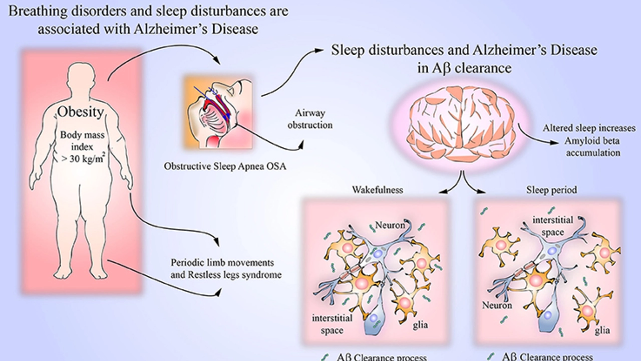 How Sleep Disorders Can Impact Your Immune System